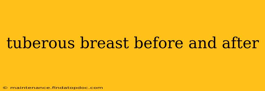 tuberous breast before and after