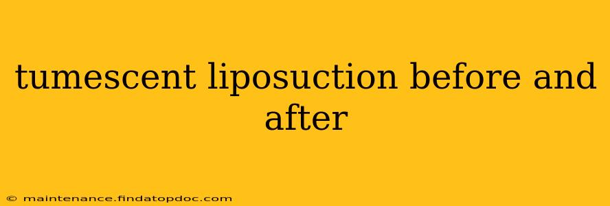 tumescent liposuction before and after