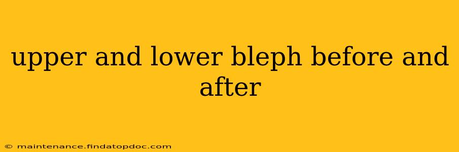 upper and lower bleph before and after