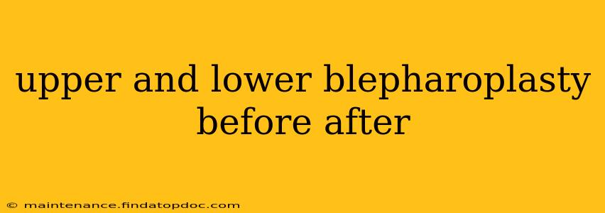 upper and lower blepharoplasty before after