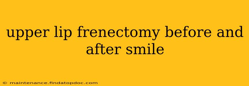 upper lip frenectomy before and after smile
