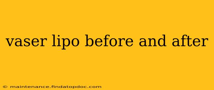 vaser lipo before and after