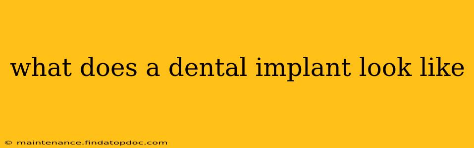 what does a dental implant look like