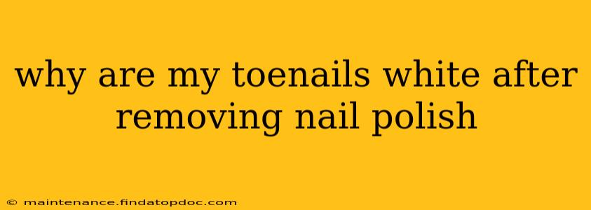 why are my toenails white after removing nail polish