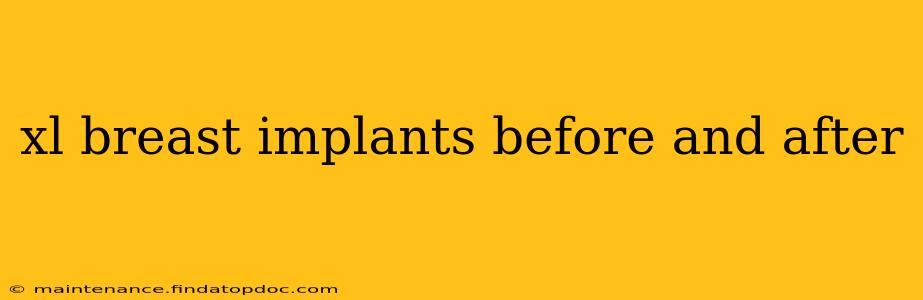xl breast implants before and after